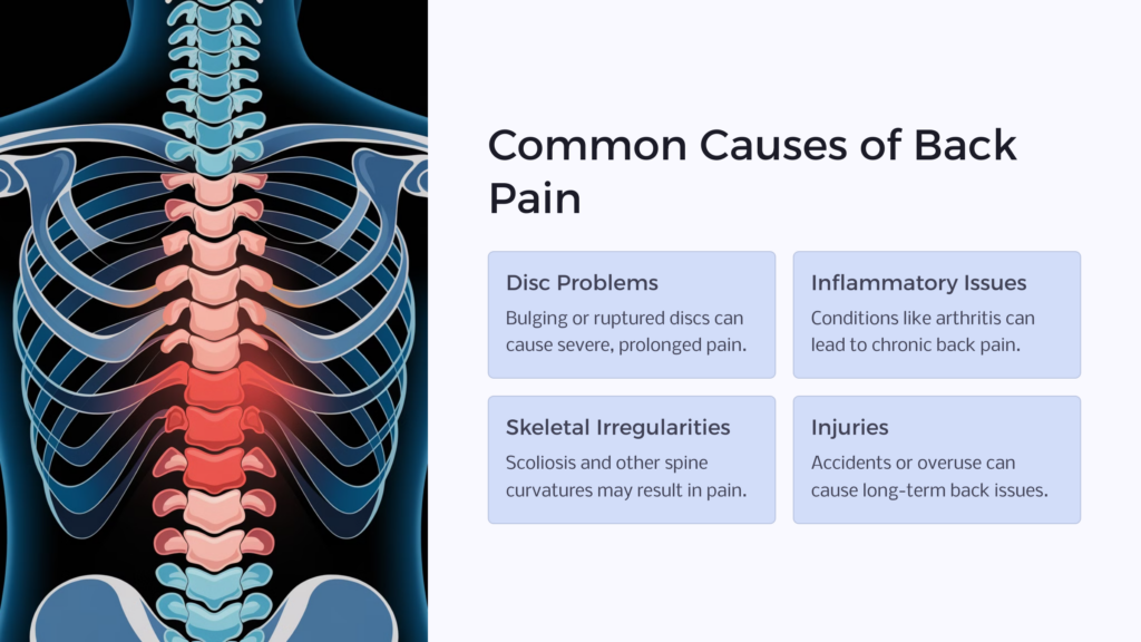 Causes of Back Pain infographic