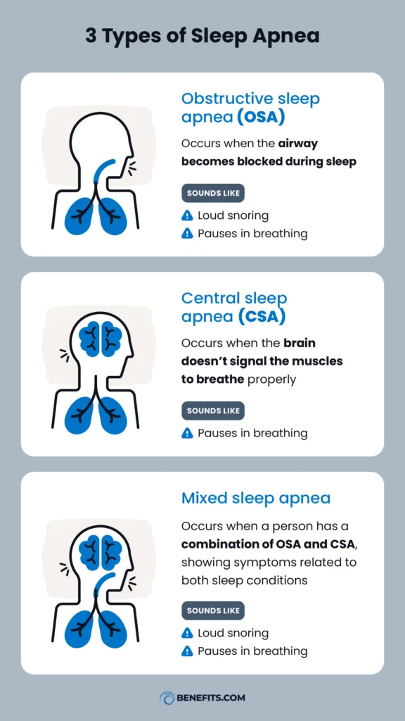The three types of sleep apnea including obstructive sleep apnea (OSA), central sleep apnea (CSA), and mixed sleep apnea.